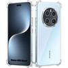 Coque Pour Honor Magic 7 Pro, Protection Silicone Antichoc Slim Coins Renforcés Transparent