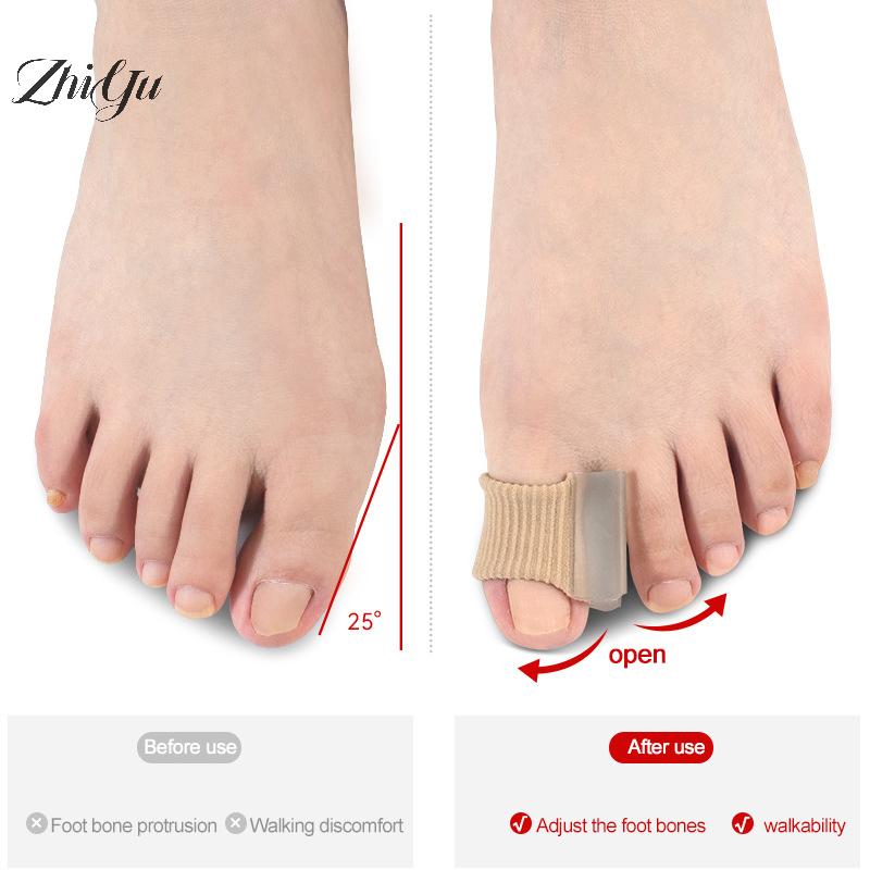 1Pcs Toe Separator Insoles Ring Separation Hallux Valgus Correction Pads Foot Care Foot Toe Hallux Valgus Correct