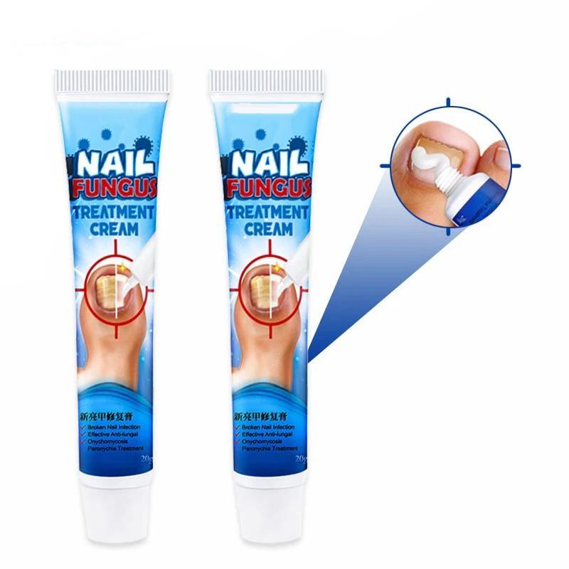 Nail Treatment Cream Antibacterial Repair Ointment Whitening Toe Anti Infection Nail Repair Cream Nail Care