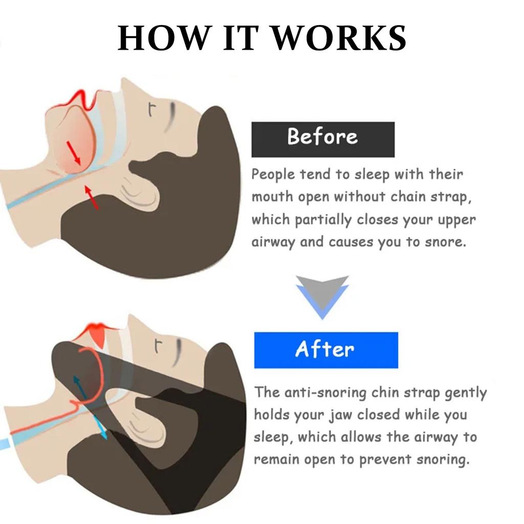 Breathable Anti Snoring Chin Strap For Men Women Comfortable Sleep Care Mouthpiece Stops Snoring