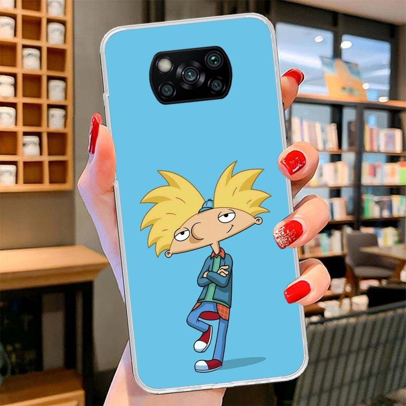 Cartoon Hey Arnold Fondos Cover Phone Case For Xiaomi Poco F7 Ultra X7 X6 X5 Pro M7 Redmi 15C 15 13C 13 12C 12 10C 10 9A 9C 9T 9