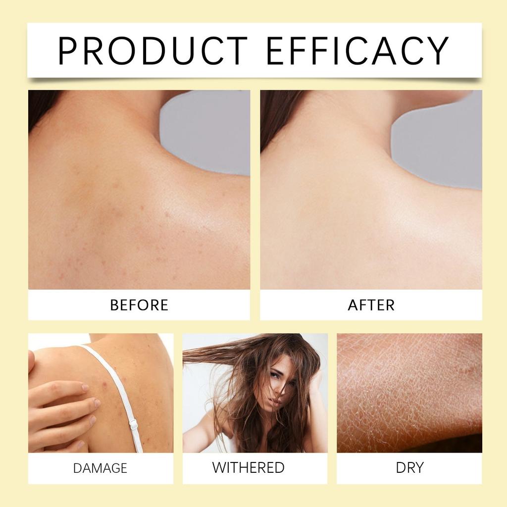 100ml E Multi-effect Skin Care Oil Moisturizing And Hydrating Face Body Hair Nourishing Skin Care Oil