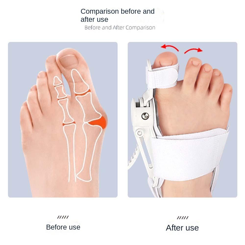 Adjustable Big Toe Straightener Bunion Splint Foot Correction Brace Bunion Corrector  Travel