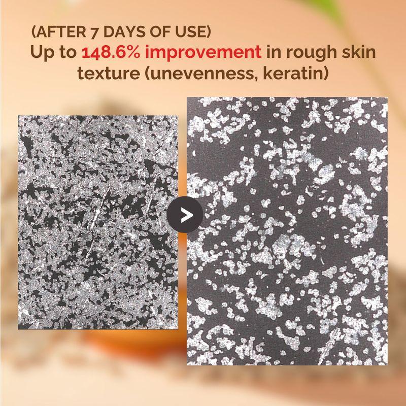 [mommy Care] Yulmu Cream 50ml