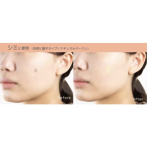 Bare Skin Sticker, Easy To Apply Concealer, Stains and Acne Scar Patch, Naturally Concealable, Ultra Thin 0.02mm, Waterproof, Made In Japan (Trial Set