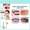Hoygi Hydrating Moisturizing Lip Balm For Soft Supple Lips With Dry Skin Relief