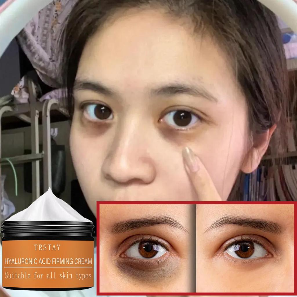 Eye Cream, Retinol, Eye Cream, Eye Cream, Dark Circles, Eye Serum, Brightening, Firming Skin Cream, Clear Skin Cream