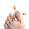 1Pair Silicone Ingrown Toenail Correction Tool Invisible Toe Nail Treatment