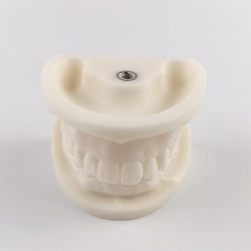 Dental Teaching Model: Oral Pathology, Restorations, Standard Implant for Doctor-Patient Communication