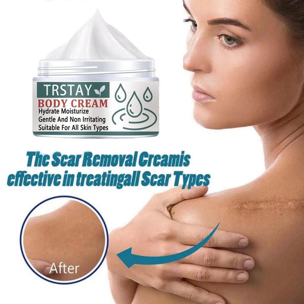 Whitening and Scar Removing Cream for Removing Scars and Acne, Anti-inflammatory and Repairing Damaged Skin, Even Skin Tone, Moisturizing Cream