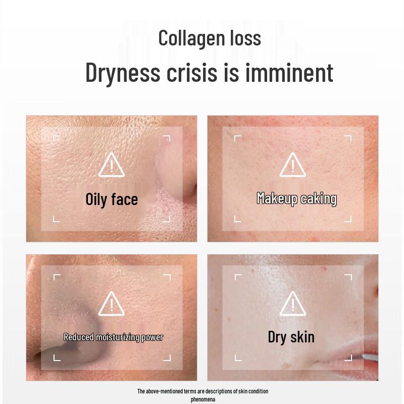 Xiehe Vitamin E Lotion