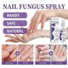 2Pcs Nail Fungus Spray, Toenail Fungus Treatment, Nail Care Solution for Toenail Feet, Fast Itch Relief