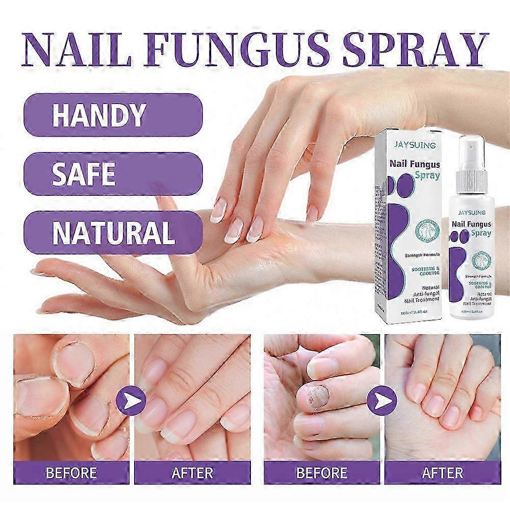 2Pcs Nail Fungus Spray, Toenail Fungus Treatment, Nail Care Solution for Toenail Feet, Fast Itch Relief