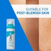 CeraVe Resurfacing Retinol Serum for Blemish-Prone Skin Non-Comedogenic 30ml
