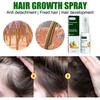 EELHOE Hair Growth Spray Essential Fast Regrowth Serum Beard Growth Oil Hair Loss Care Beauty Hairline Scalp Treatment for Men Women