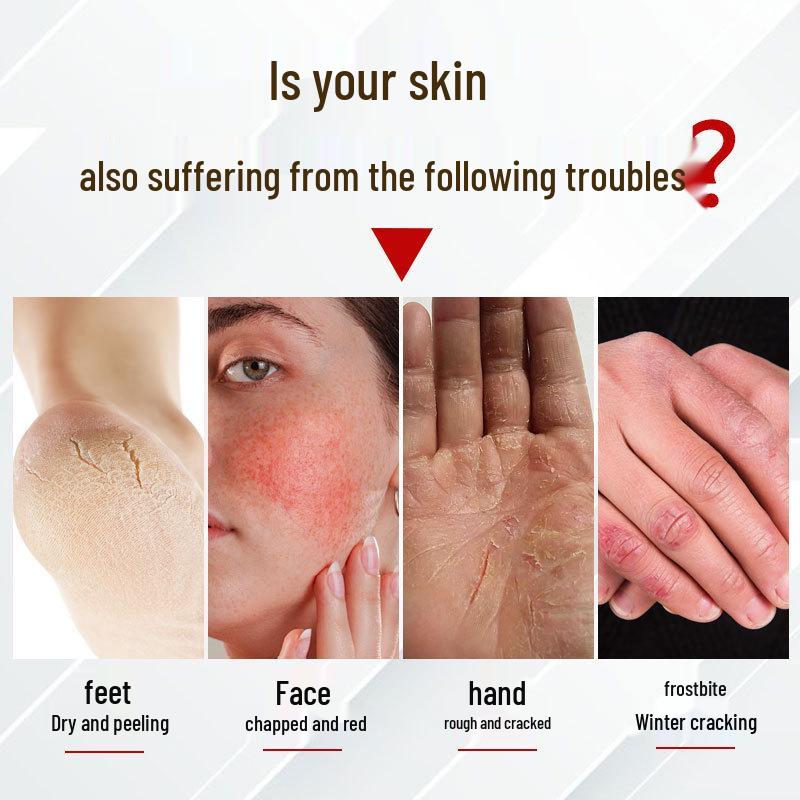 German Mihao Emu Oil Cream for Dry, Cracked Hands & Feet - Moisturizing & Itch Relief Winter Care