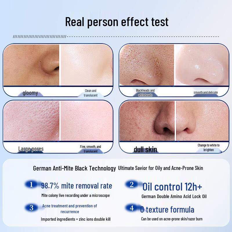 BVSYL Anti-Acne & Oil Control Facial Cleanser