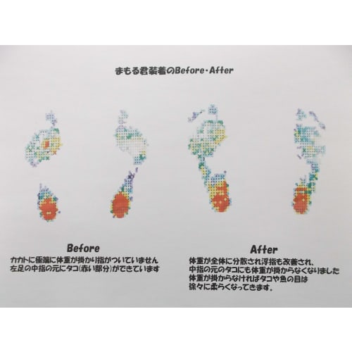 Women's Arch Support Insoles for Foot Pain, Foot Fatigue, Calluses, and More. Perfect for High Heels, Pumps, Boots, and Sandals. [Mamorukun]