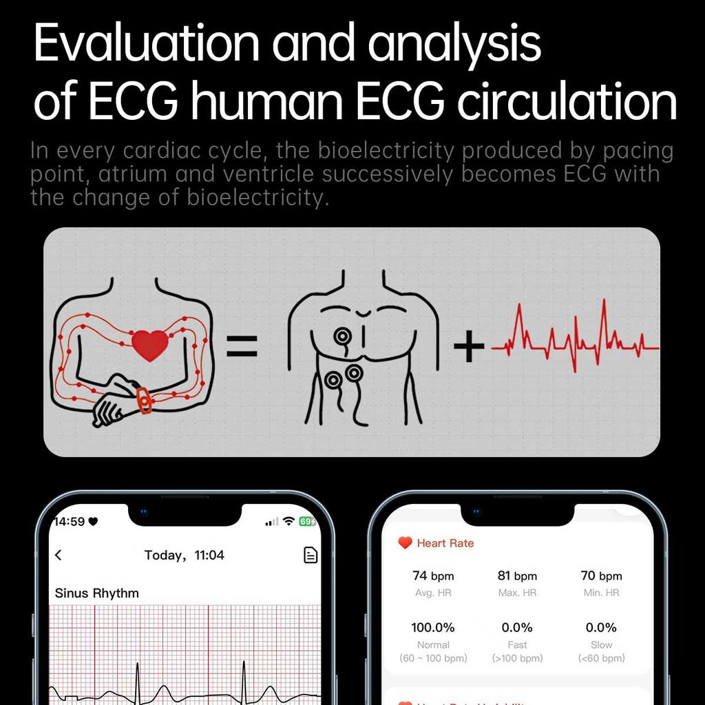 2025 NEW Health Micro Physical Examination Smart Watch ECG BP Blood Oxygen Uric Acid Blood Fat Temp Bluetooth Call SmartWatch
