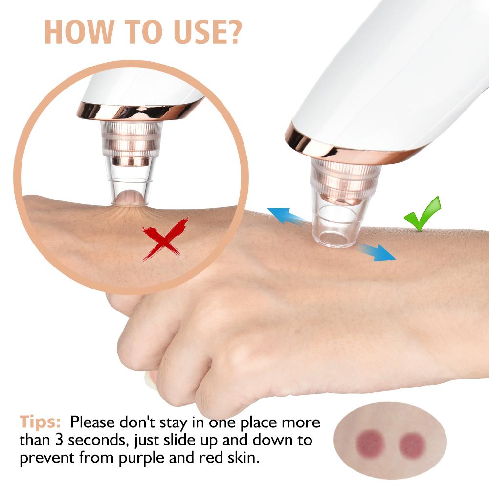 Blackhead Remover Pore Acne Pimple Removal Face T Zone Nose Cleaner Vacuum Suction Facial Diamond Beauty Clean Skin Oil Dirty