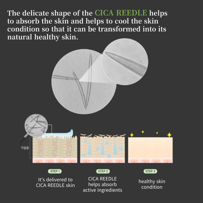 VT mįslės šūvis 100