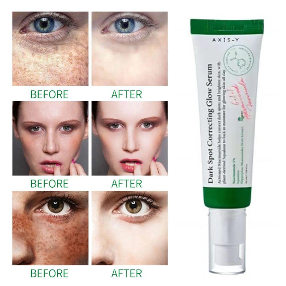 Non-Greasy Refreshed Essence Fade Color Spots Freckles Cream Moisturizing Essence  Face Skin