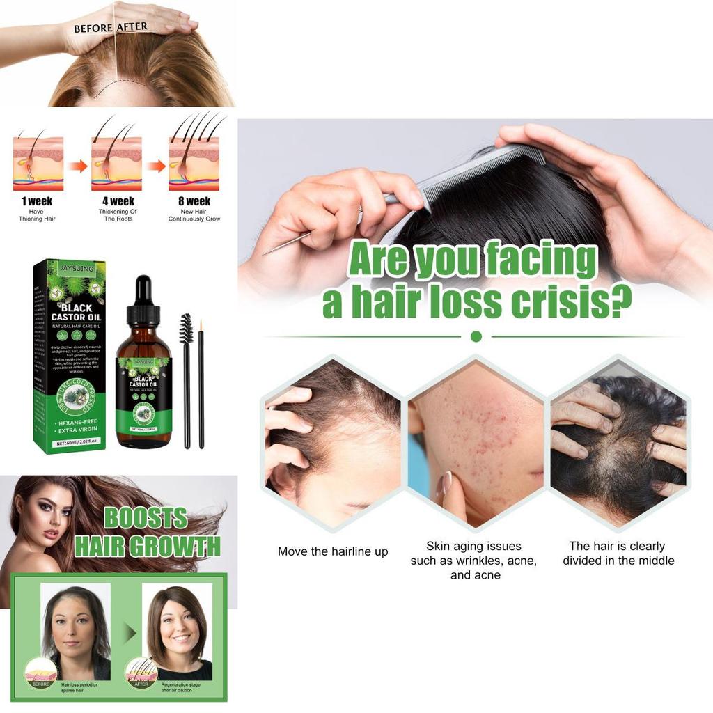 Jaysuing Castor Oil Hair Growth Serum Nourishing Moisturizing Anti Hair Loss 60ml