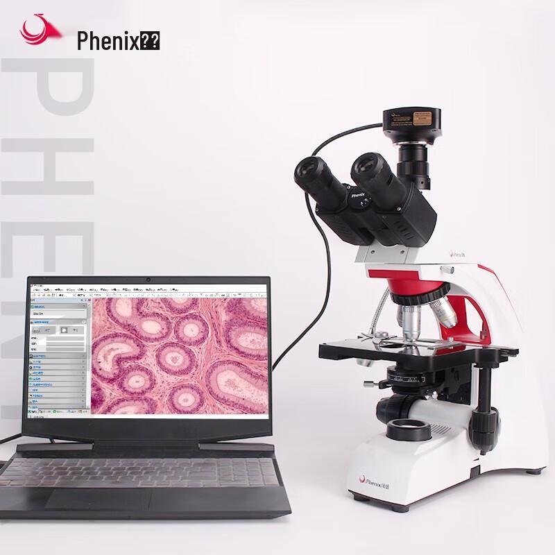 

Phenix Digital Microscope Eyepiece Camera