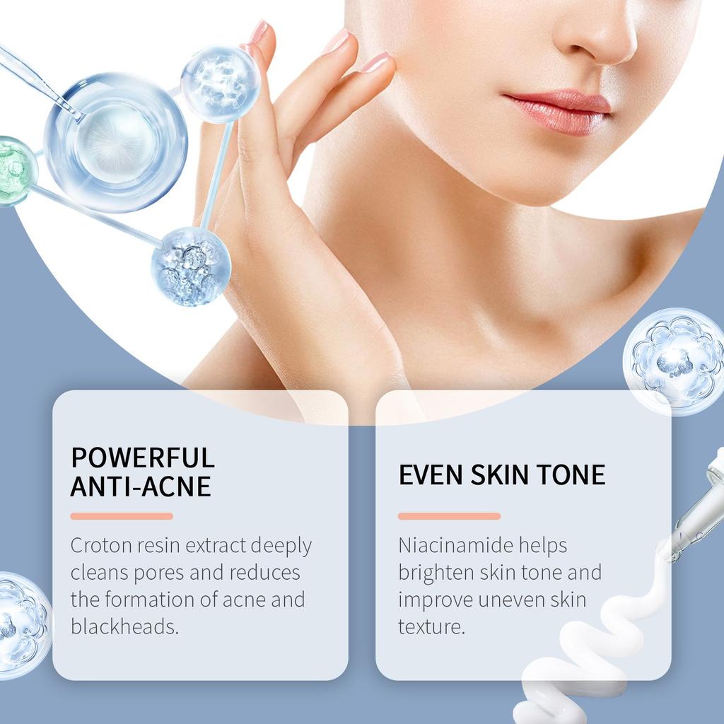 Cleansing Acne And Skin Rejuvenation Gel Facial Skin Exfoliation Blackhead Cleansing And Refreshing Moisturizing