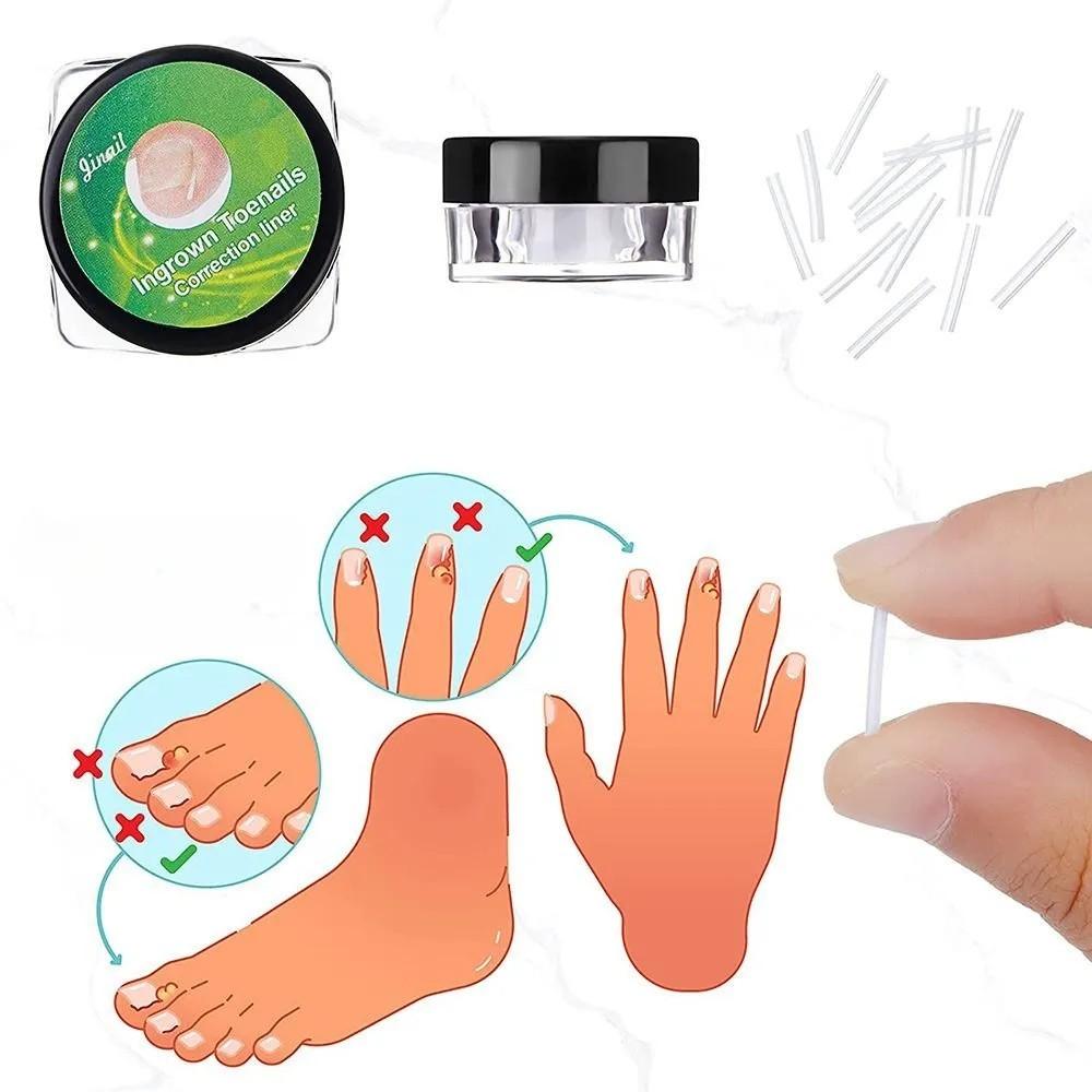 20PCS Ingrown Nail Filling Pad Sleeve Nail Pad C-shaped Nail  Pad Ingrown Nail Corrector Pedicure Tool