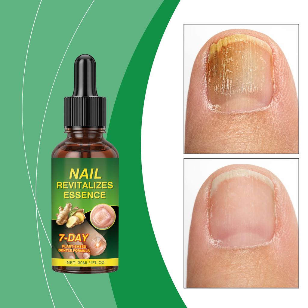Nail &Moisturizing Lotion Moisturizes, Strengthens And Brightens Nail Surface, Gently Cleans Cutin, Cares For Fingertips, And Maintains 30ml