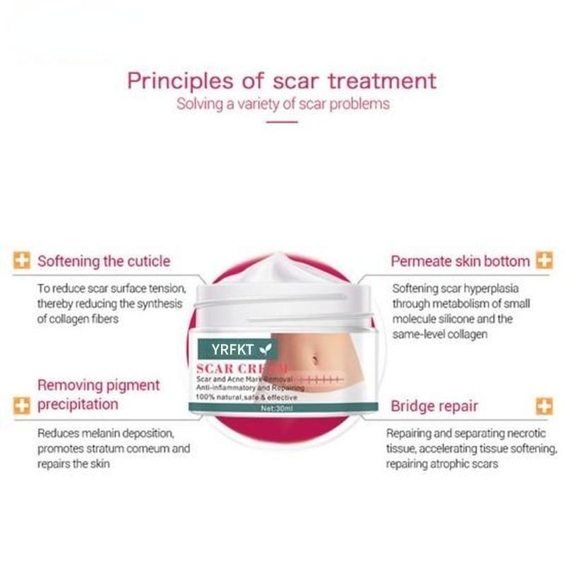 Cremă de întindere pentru cicatrici pentru acnee