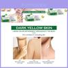 Creme Suave para Acne Corporal Hoygi Tratamento Nutritivo Hidratante Para Pele Lisa