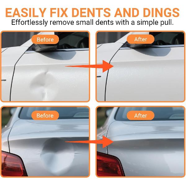 2-Pack Car Dent Puller, Dent Puller Kit With Strong Suction Cups, Car Dent Remover Tool For Auto Body Repair, Compact Car Dent Repair Kit For Glass,