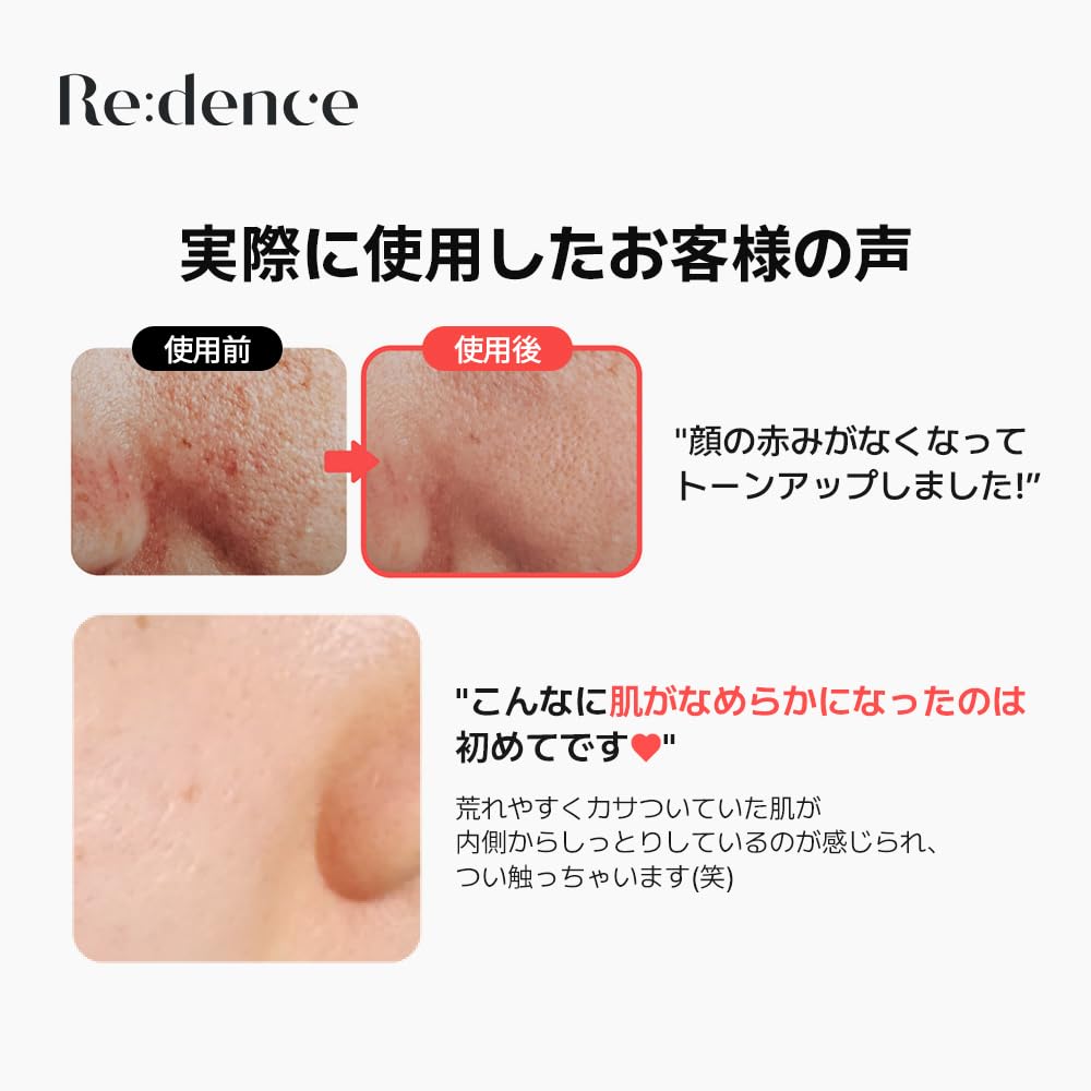 Tone Spot Skin Booster Toner 300ml [Redence] &