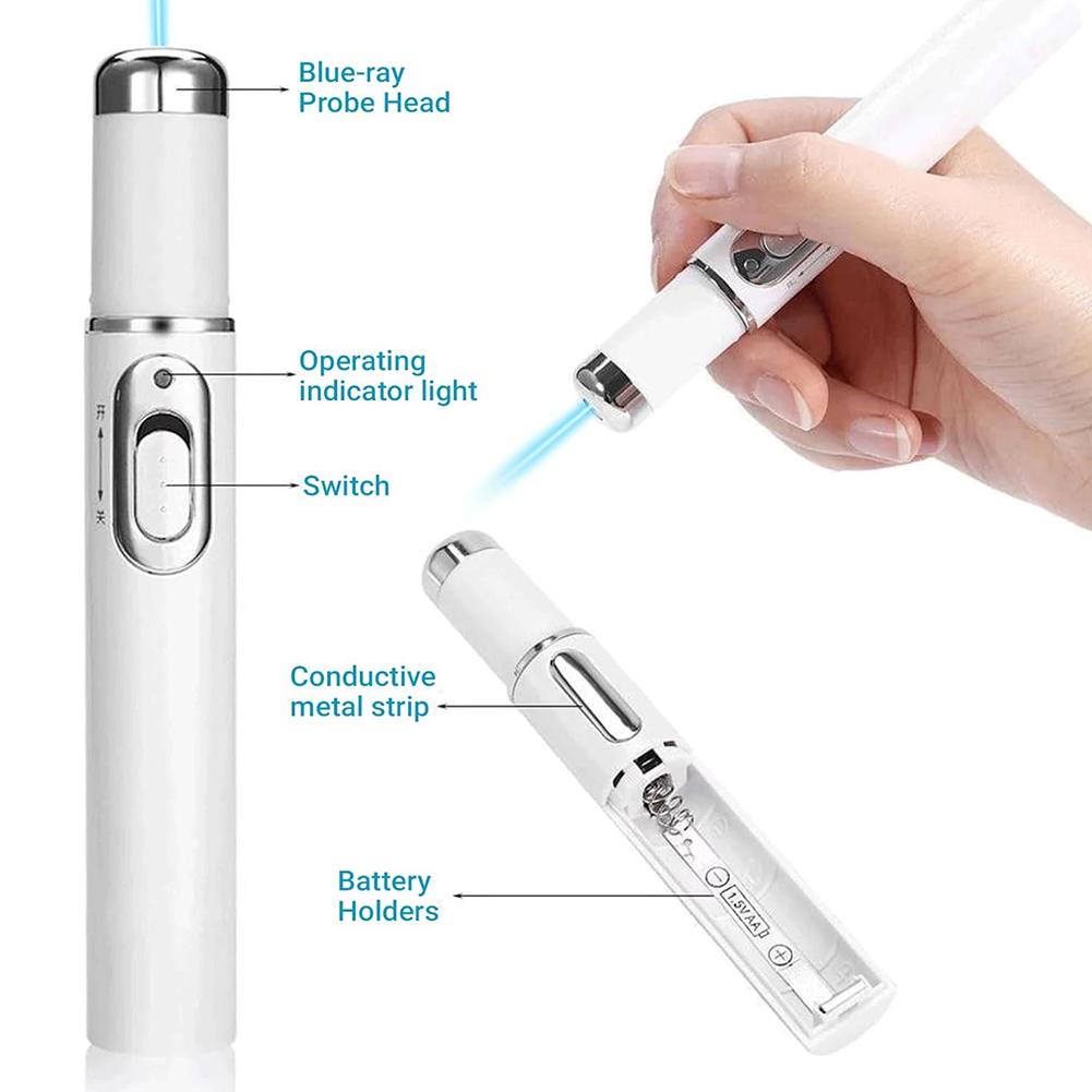 Blue Light Acne Pen Heated Eye Massager Eye Massage Instrument for Dark Circles Eye Bags Puffiness Under Eyes Beauty Pen