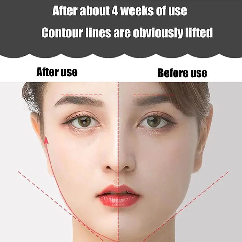 EMS Face Lifting Roller RF Double Chin V Face Shaped Facial Massager Jaw Cheek Thin Slimming Facial Lift Up Belt Skin Care Tool