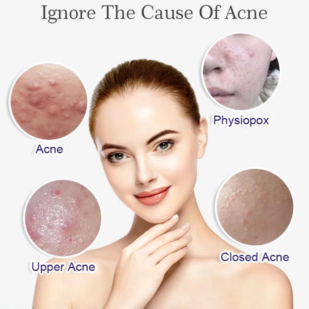 Rice Essence Moisturizing, Hydrating And Brightening Essence Essence Skin Care Products