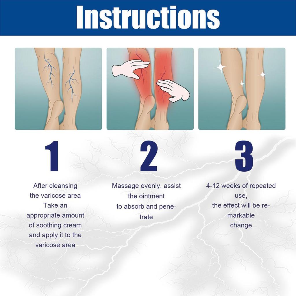 Crema de ingrijire albitoare, textura cremoasa, amelioreaza flebita si vasculita, hidratanta si hidratanta