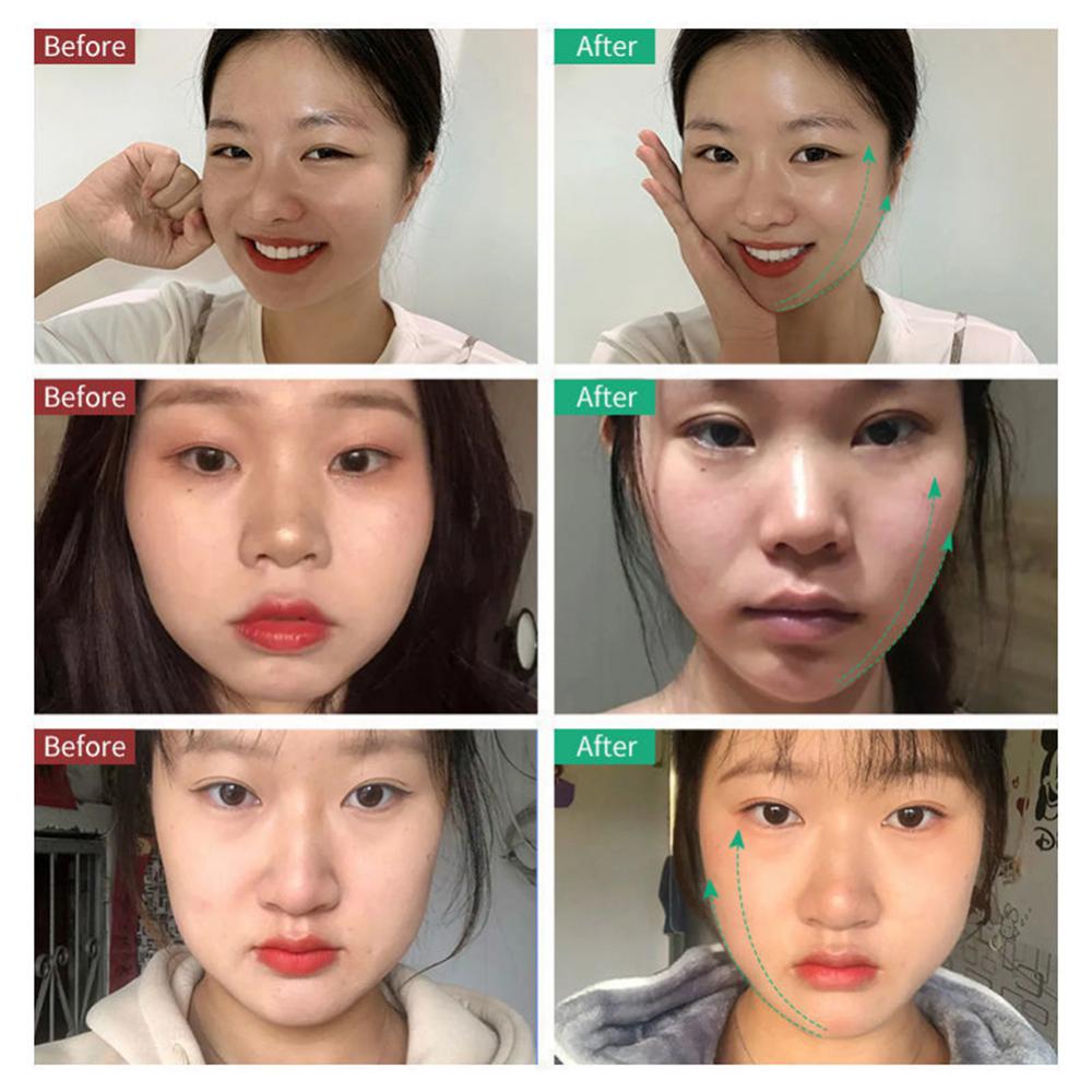 Facial Lifting Device LED Photon Therapy Facial Slimming Vibration Massager Double Chin V-shaped Cheek Lift Face