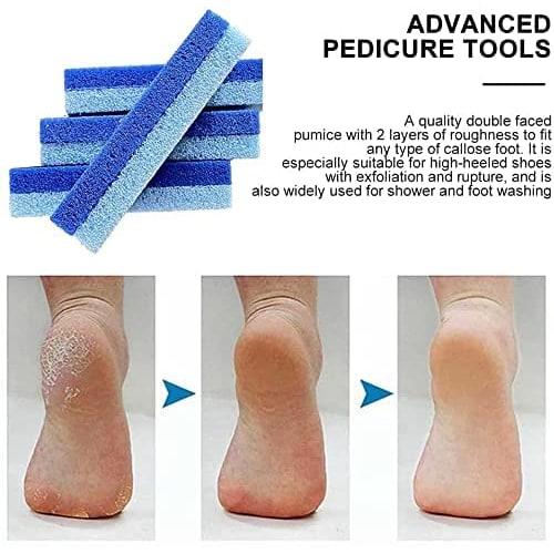 4-Piece Double-Sided Foot Pumice Stones, 2-in-1 Callus Remover Pads, Pedicure Stone Scrub for Hard Skin, Callus Remover for Feet and Hands