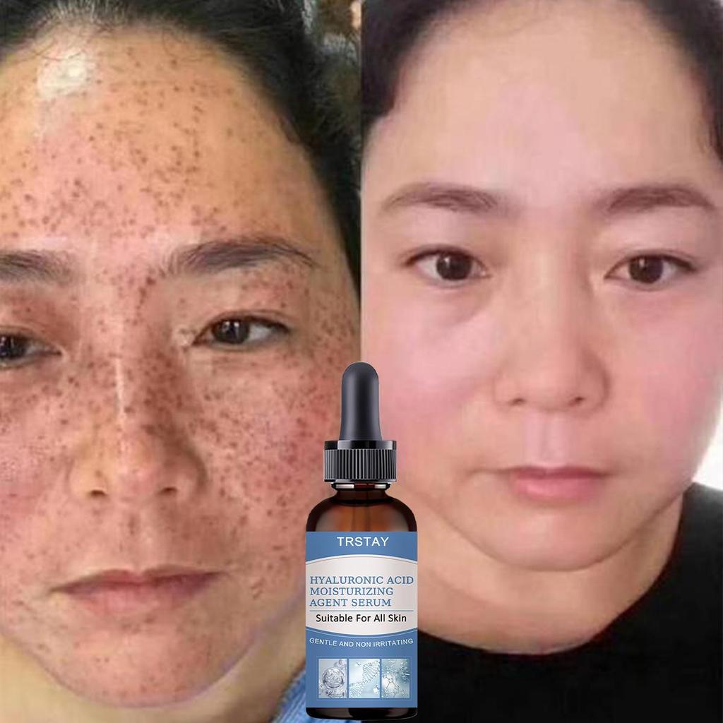 Black Spot Correction Cream Active Vitamin C Retinol Face Cream Spot Removing Whitening&Brightening Face Cream