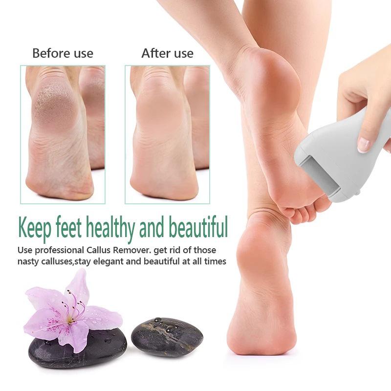 New Home Electric Foot File Callus Remover - Remove Dead Skin for Smooth Feet