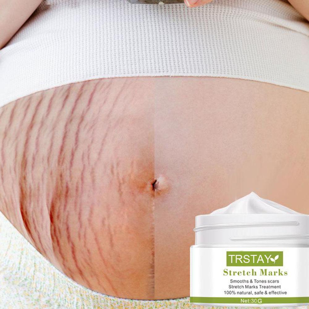 Moisturizing care cream, stretch mark repair cream