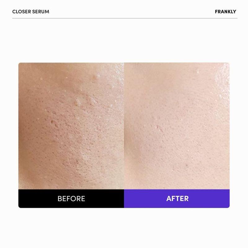 FRANKLY Closer Pore Reducing Serum Jumbo