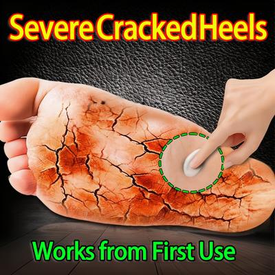 Crack Repair Cream: Ends Bleeding Cracks with Deep Barrier Repair