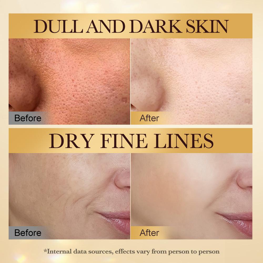 Beevenom Firming Brightening Nourish 6-piece Anti-wrinkle Whitening Skincare Set Luxury Gift Box