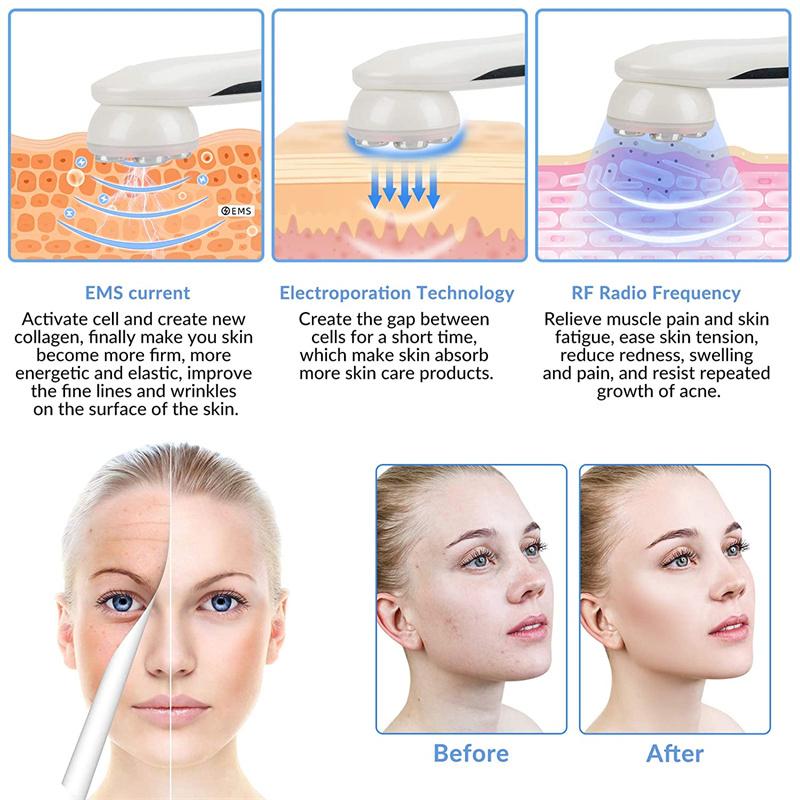 KinseiBeauty EMS LED fotonový masážní přístroj Mezoterapie Elektroporace RF radiofrekvenční přístroj pro péči o pleť obličeje Face Lift Tighten Beauty Machine