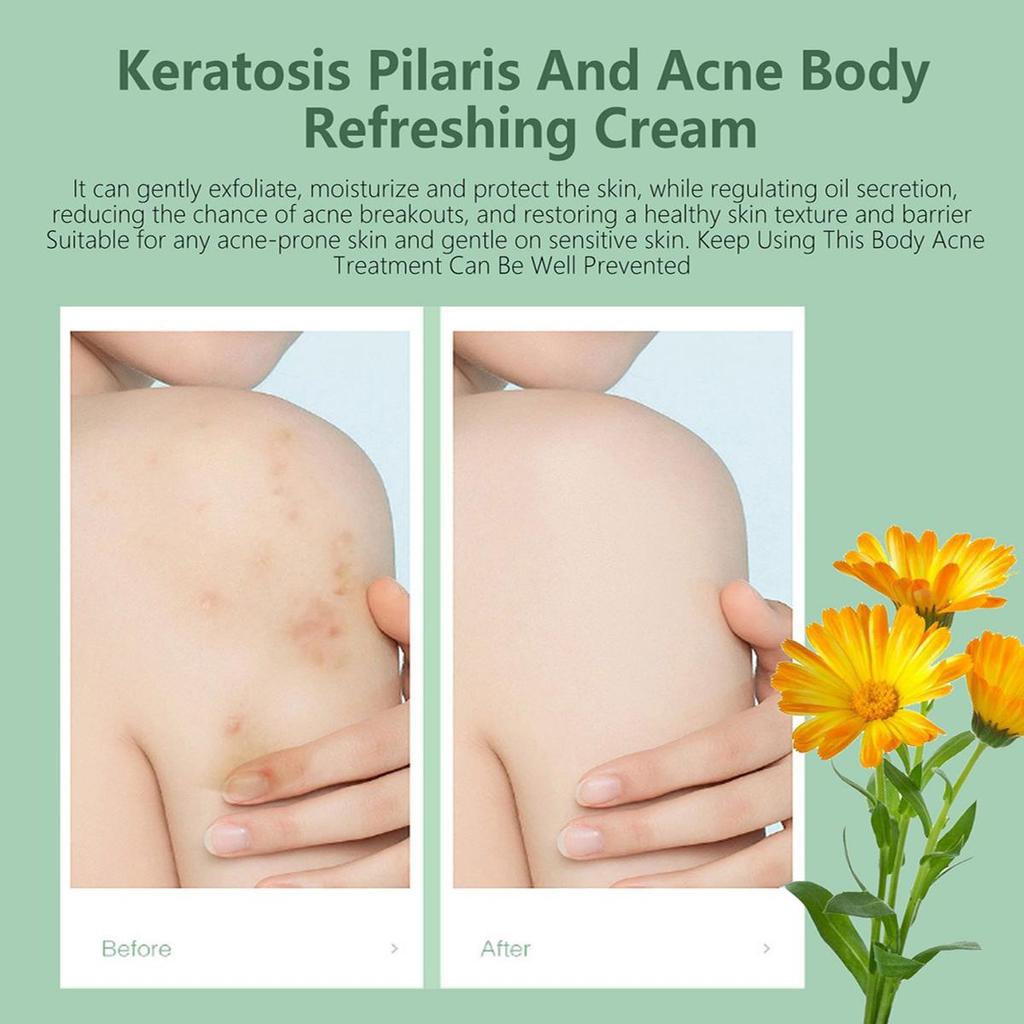 Whitening Skin Oil Control Cover Pores Acne Skin Whitening Cream