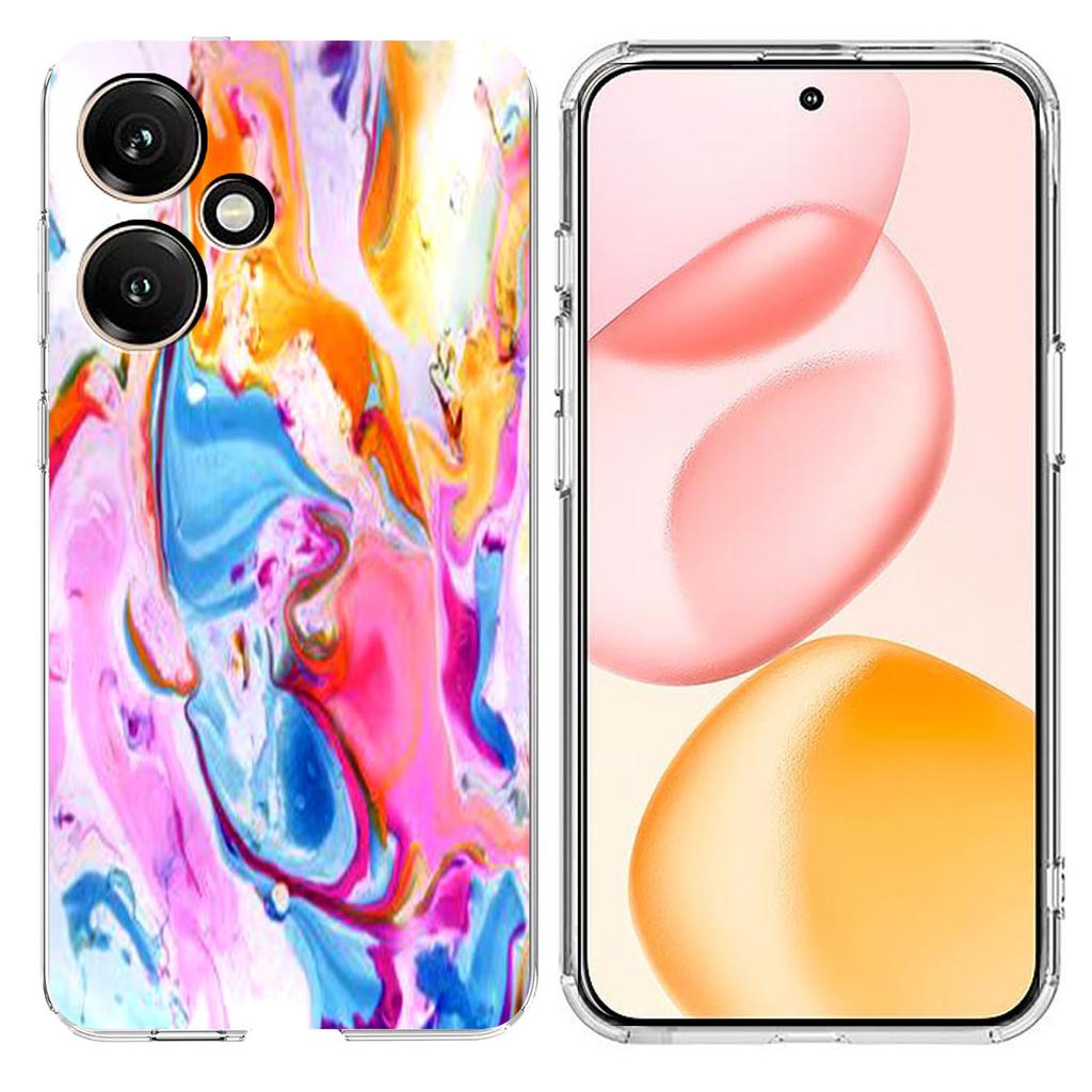 For Honor 400 5G (Global) Case Marble Pattern Printing Soft TPU Phone Cover